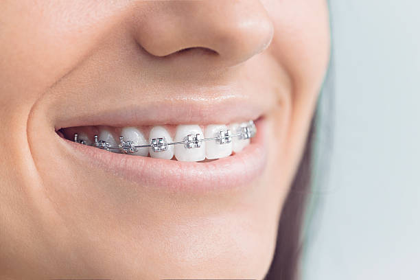 Get a Perfect Smile with an Expert Orthodontist in Rochester NY – rochesterfamilyorthodontics